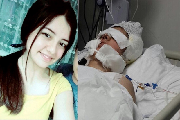 Burun ameliyatında beyin kanaması geçiren Kübra öldü