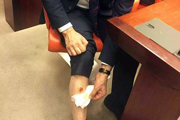 CHP’li vekil AK Partili vekili bacağından ısırdı
