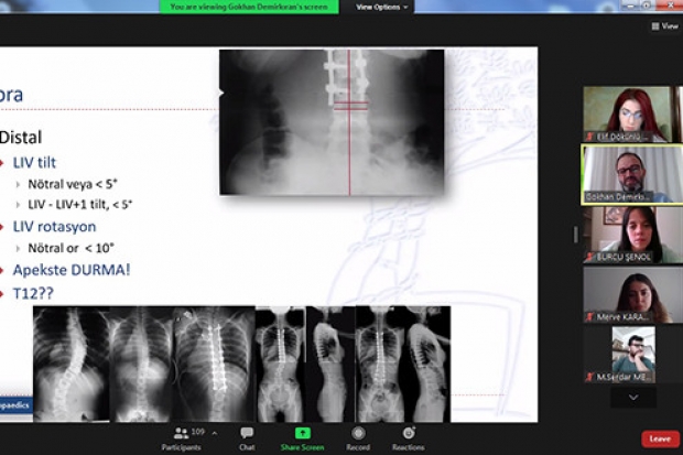 Omurga eğriliklerinin tedavi yaklaşımları anlatıldı