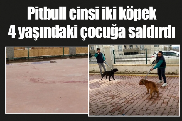 Pitbull cinsi iki köpek 4 yaşındaki çocuğa saldırdı